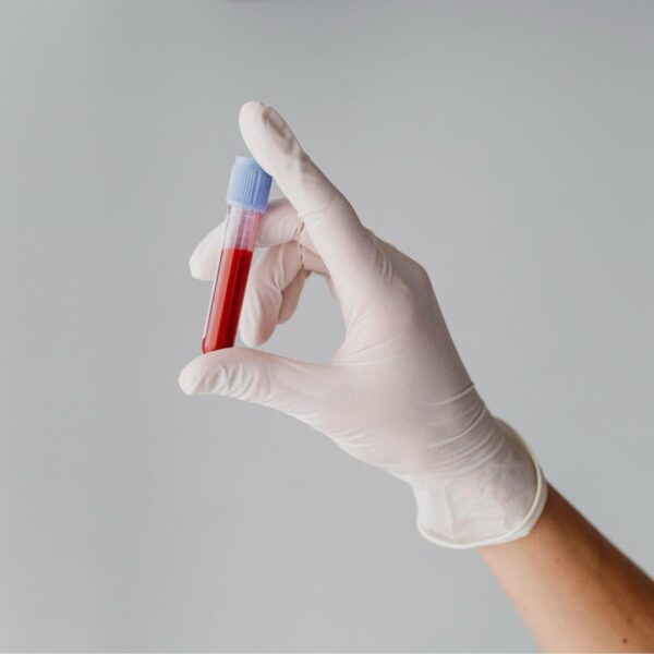 Chequeos preventivos: un hábito que puede salvar vidas